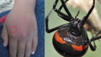 Niño se hace picar por una viuda negra para convertirse en Spider-man | Video