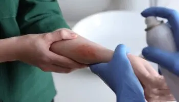 La piel: un reflejo del estrés psicológico