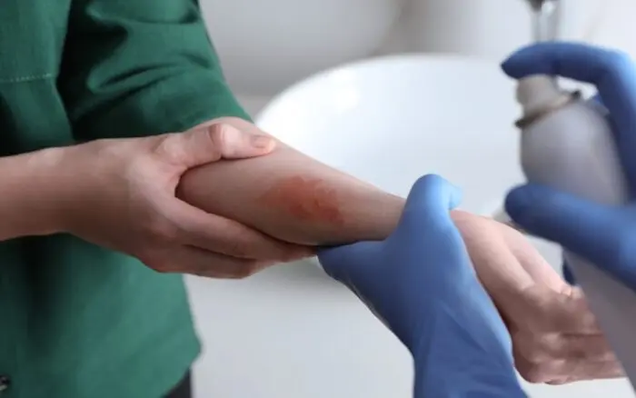 La piel: un reflejo del estrés psicológico