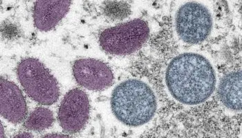 El 75% de las enfermedades infecciosas emergentes son transmitidas a los humanos por animales: especialista