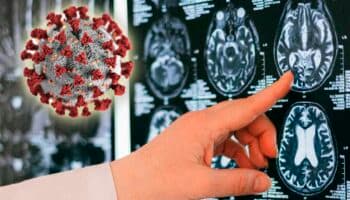 Descubren el mecanismo que utiliza el SARS-CoV-2 para infectar el cerebro