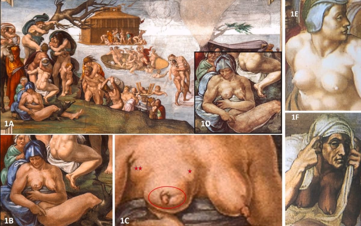 Miguel Ángel pintó en la Capilla Sixtina una mujer con signos de cáncer de mama | Video