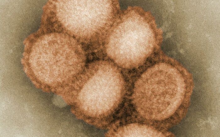 El Mundial podría provocar nueva oleada de casos de sarampión en México, alertan expertos