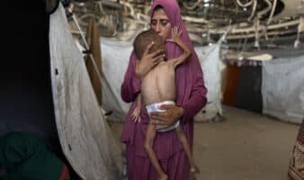 Más de 54 mil 600 menores sufren desnutrición severa en Gaza