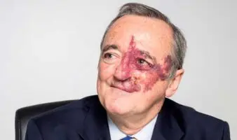 Academia de Ciencias retira artículo de Barbacid sobre avances para combatir cáncer